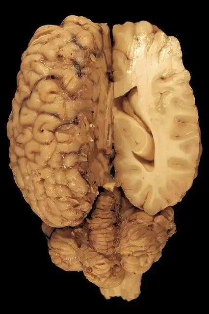 cerebrum image